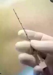 剖腹产麻醉视频,从术前准备到术后恢复